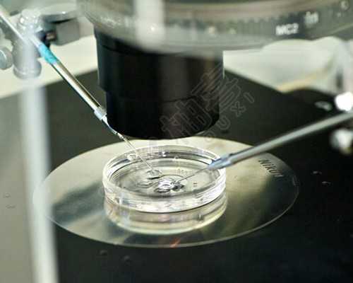 广州包性别套餐 广州正规生殖医院列表 ‘根据b超单看男女准吗’