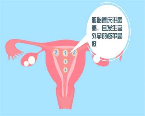 广州代孕手续-为什么支持广州代孕-广州找亲戚代孕试管婴儿